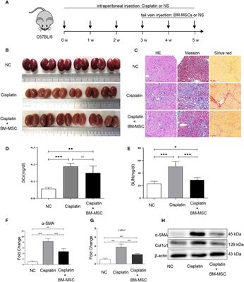 Bone Marrow Mesenchymal Stem Cells Ameliorate Cisplatin-Induced Renal Fibrosis via miR-146a-5p/Tfdp2 Axis in Renal Tubular Epithelial Cells